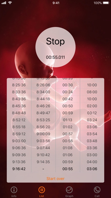 Contraction counter