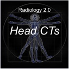 Radiology 2.0: Head CTs