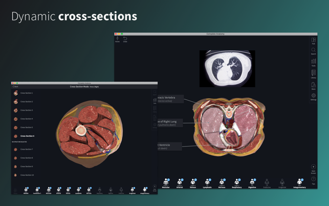 Complete Anatomy 2018 3 3 – Anatomy Learning Platform Similar