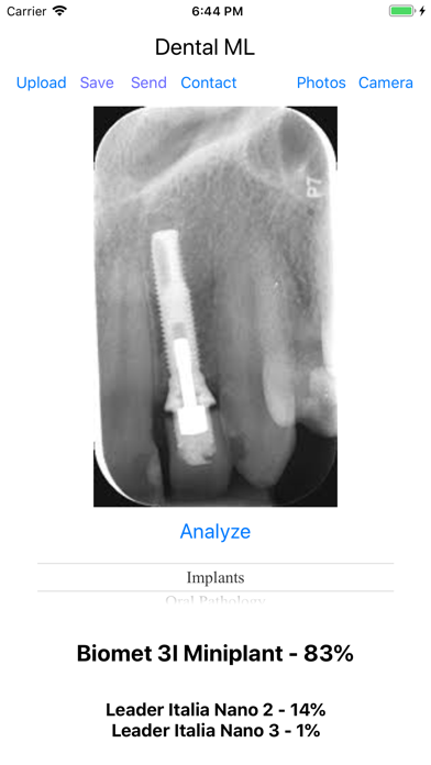 Dental ML screenshot 3