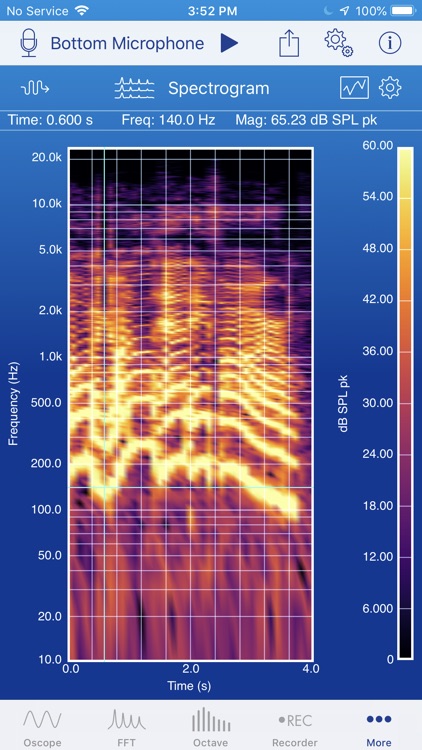 SignalScope Advanced 2018