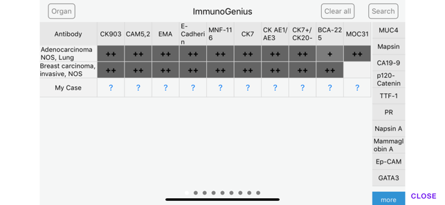 ImmunoGenius(圖5)-速報App