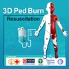 3D PED Burn Resuscitation
