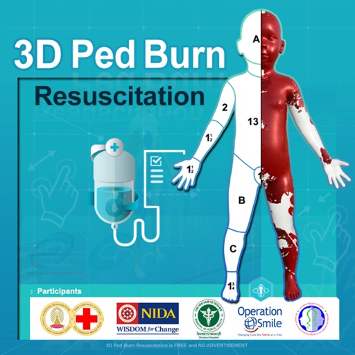 3D PED Burn Resuscitation