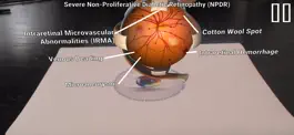 Game screenshot Diabetic Retinopathy AR apk