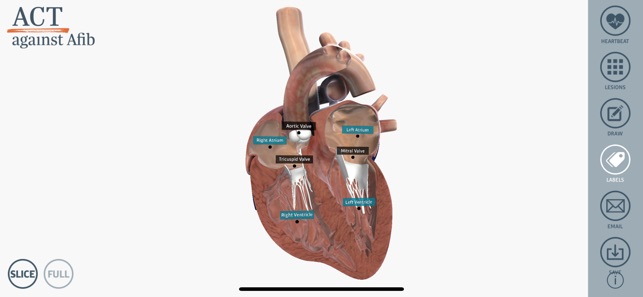 ACT 3D Heart(圖2)-速報App