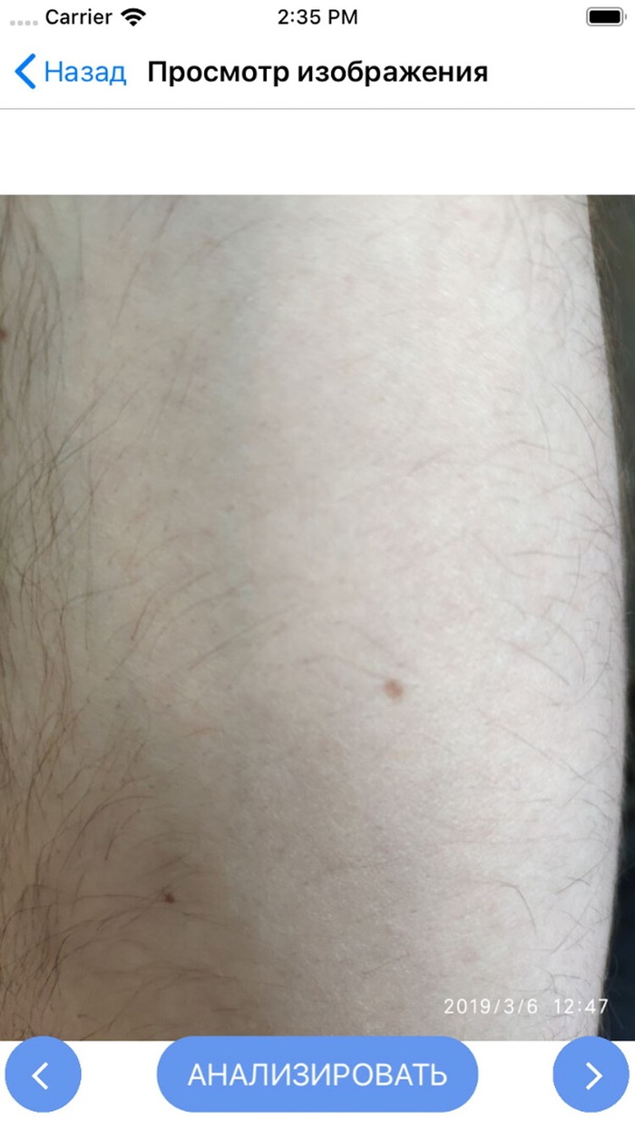 DermaScan for doctors