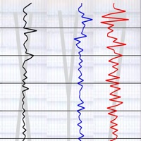 Vibration Detect II