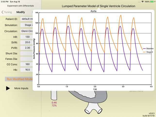 Single Ventricle Circulation(圖3)-速報App