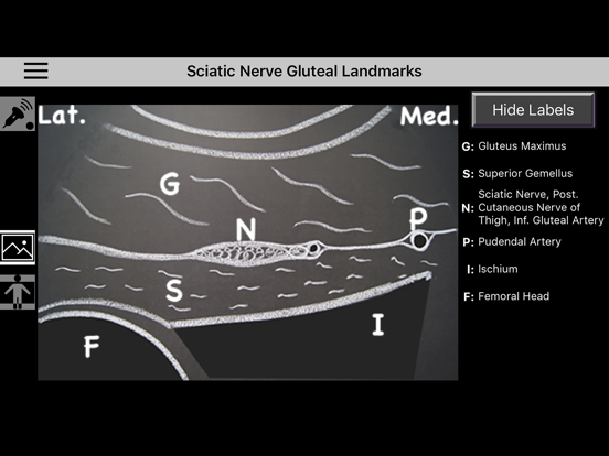 AnSo Anaesthesia Sonoanatomy AnSo Anaesthesia Sonoanatomy