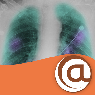 COPD @Point of Care™