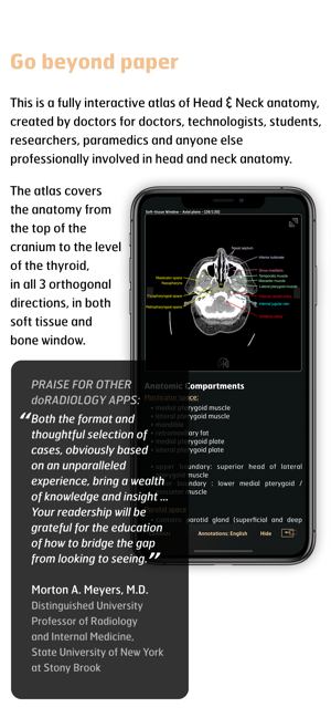 Radiology - Head&Neck Anatomy(圖2)-速報App