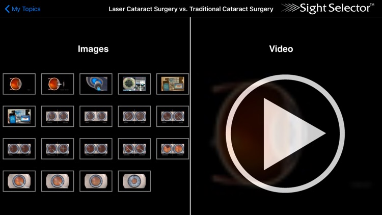 Sight Selector Subscription