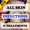 Skin Infections and Treatments