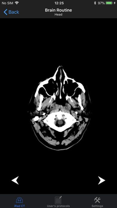 iRad CTのおすすめ画像4
