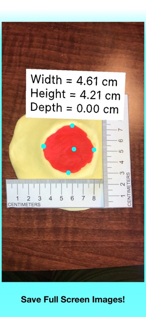 Wound Measurement