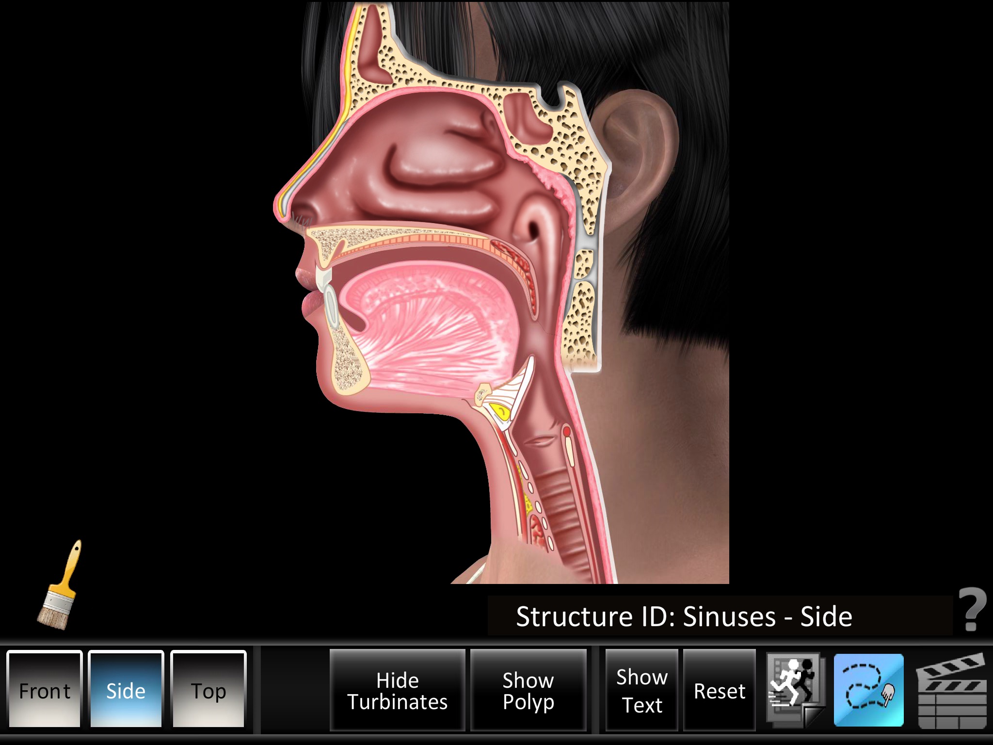 Sinus ID screenshot 4