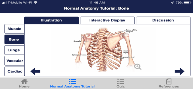 CTisus Chest Atlas 3D CRT(圖2)-速報App