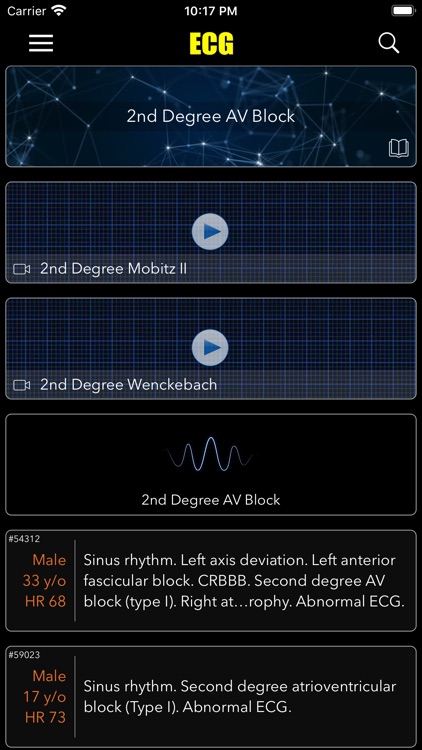 ECG / EKG