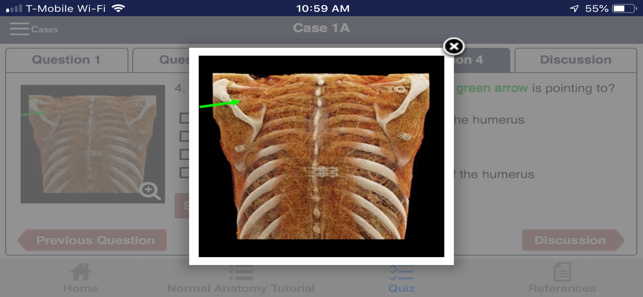 CTisus Chest Atlas 3D CRT(圖7)-速報App