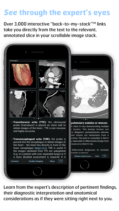 How to cancel & delete Thoracic Imaging Fundamentals from iphone & ipad 4