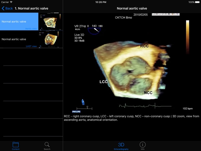 CARDIO3®3D Echocardiography HD(圖2)-速報App