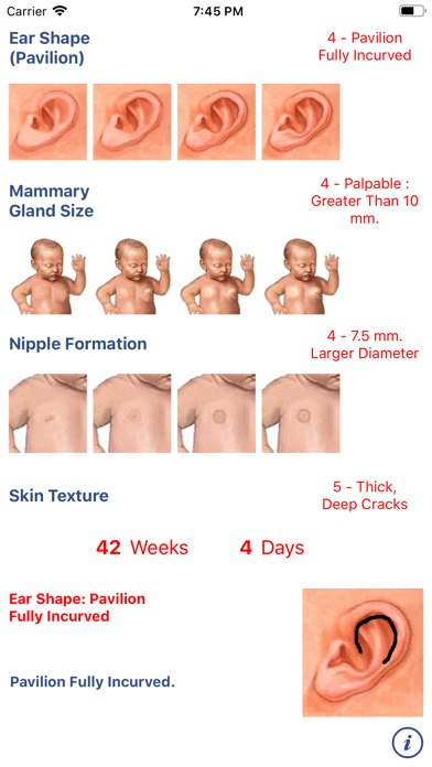 How to cancel & delete Neonatology: Test Capurro from iphone & ipad 2