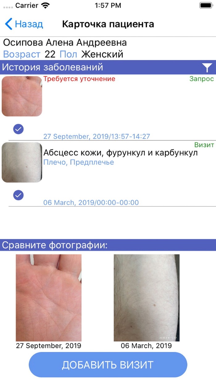 DermaScan for doctors