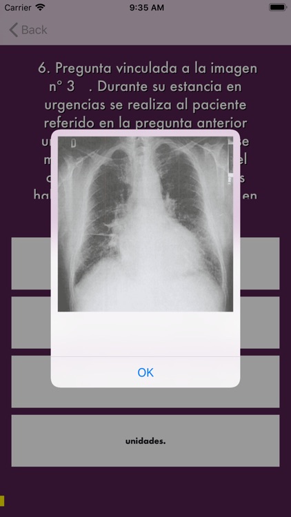 Preguntas Examen MIR Medicina screenshot-3