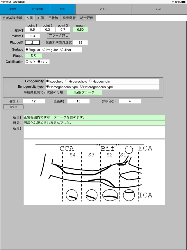 US-carotid(圖3)-速報App