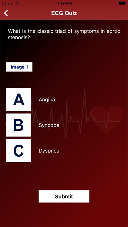 ECG QUIZ