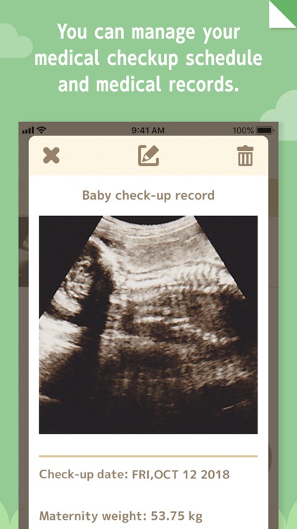 280days : Pregnancy Diary App screenshot-4