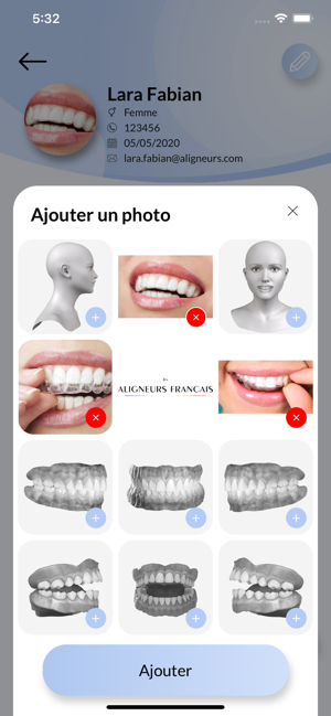 Aligneurs Français(圖4)-速報App