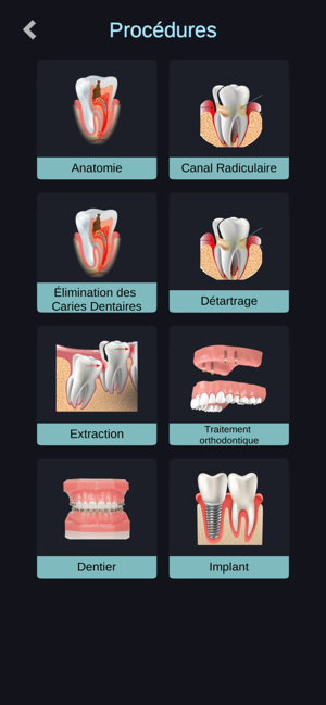 IDental French(圖5)-速報App