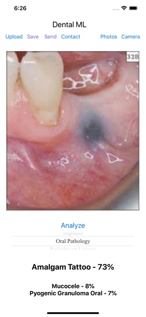 Dental ML(圖2)-速報App