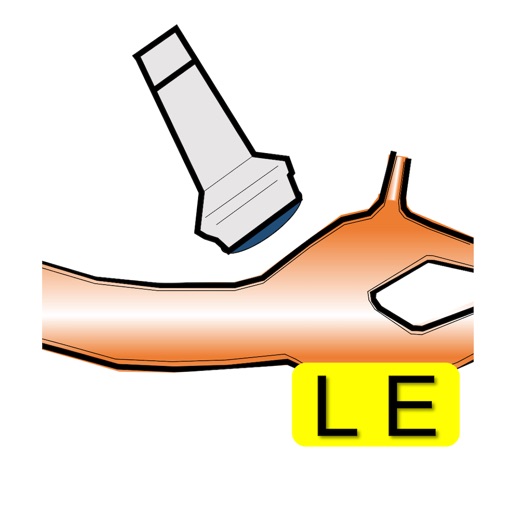 US-carotid