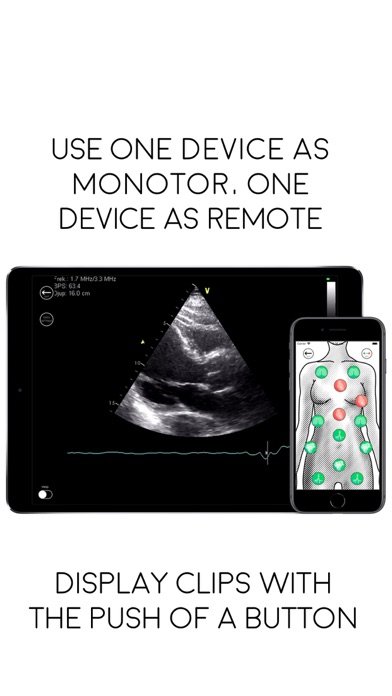 Awesome Ultrasound Si... screenshot1