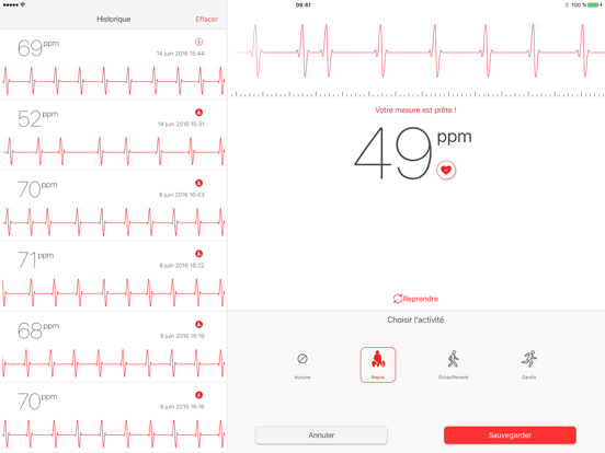 Cardiographe Cardiographe