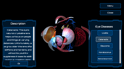 How to cancel & delete Anatomy Human Eye from iphone & ipad 4