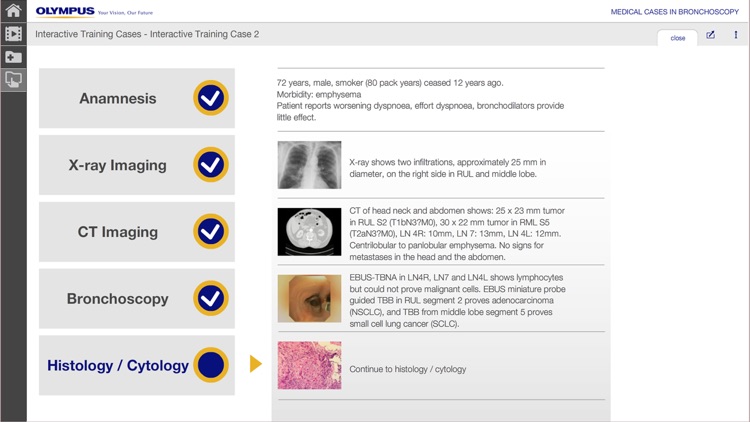 BronchoCases screenshot-3