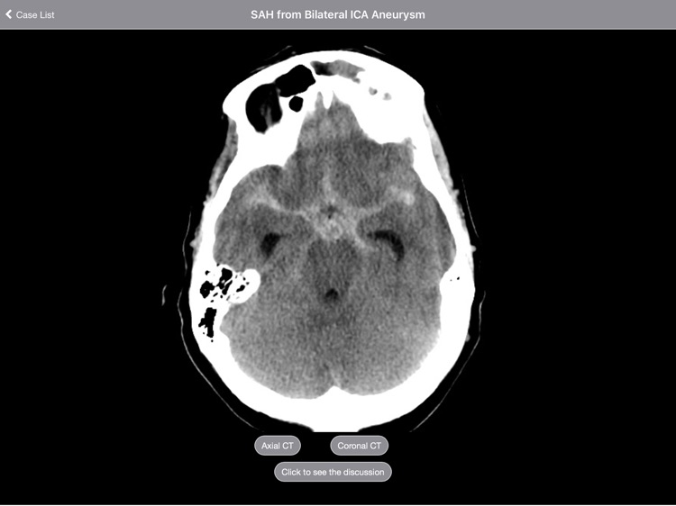 Radiology 2.0: Head CTs