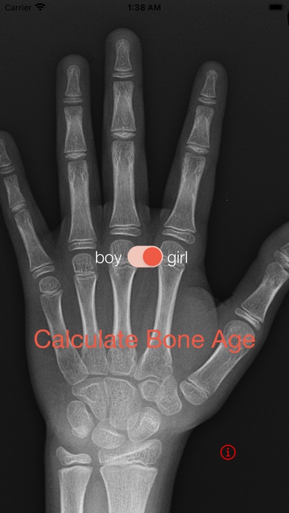 Bone Age