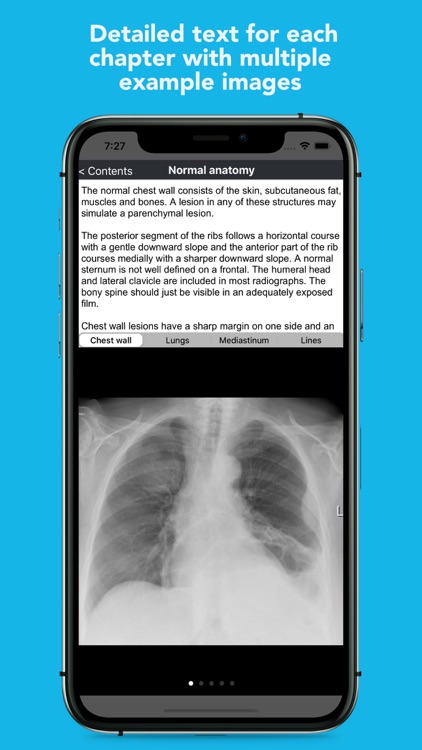 iCXR - Chest xray manual