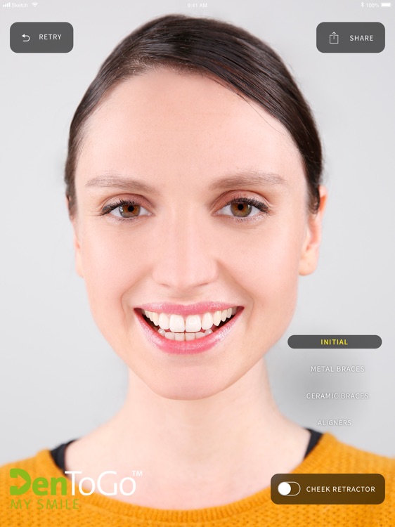 MySmile by Straumann screenshot-4