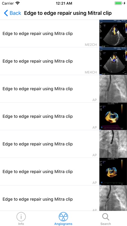 CARDIO3® Interventional Atlas