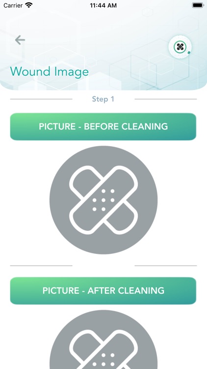 Wound 'AI'd(Clinical Trial) screenshot-4
