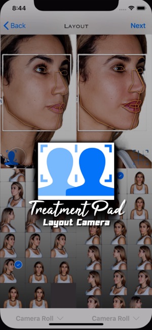 Treatment Pad - Layout Camera(圖4)-速報App