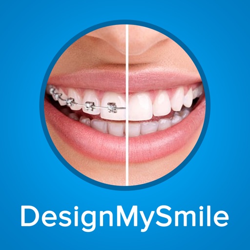 Design My Smile