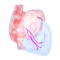 Developed for healthcare professionals, medical and nursing students who are interested in a deeper understanding of Atrial Fibrillation