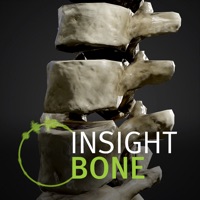  INSIGHT BONE Alternative